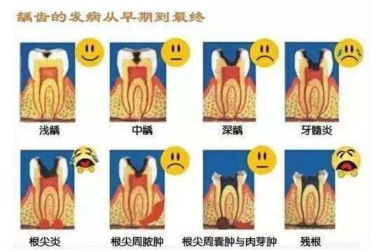 冠心病引起的牙疼与牙病的区别,除了牙病以外什么病能引起牙疼