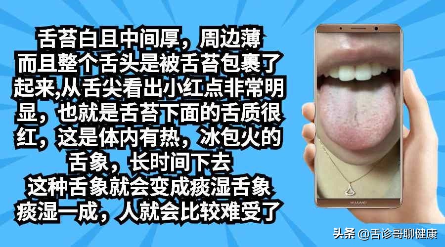 舌诊哥舌象分析视频,舌诊歌健康问答全集
