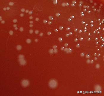 精子会寄生细菌吗,精子多种细菌混合生长