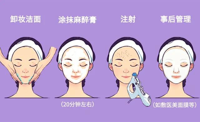 打水光针的作用真的那么好吗,打水光针用麻药吗