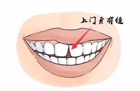 6-12岁换牙怎么换一口好牙,7岁换牙期注意事项怎么才整齐