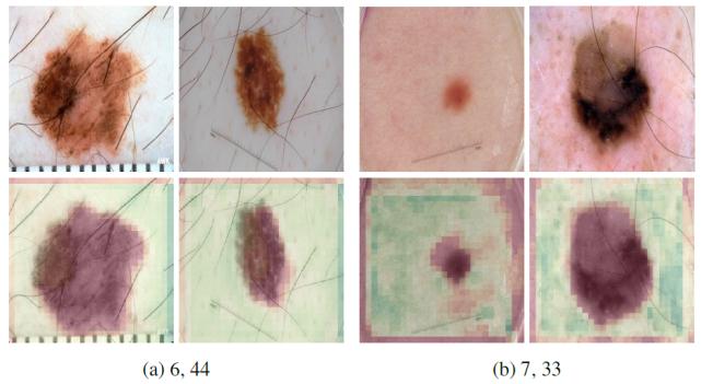 浅谈医学影像学习与实践,基于深度学习的医学影像研究思路
