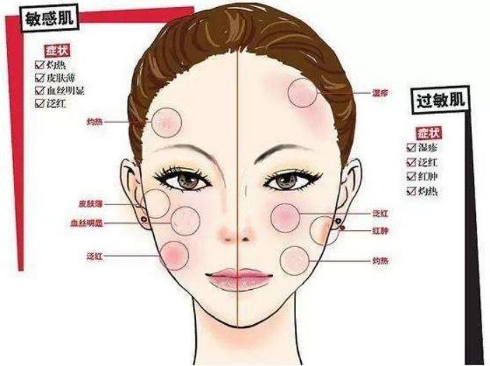 脸上有大面积红血丝怎么遮瑕,一白遮百丑的真实含义