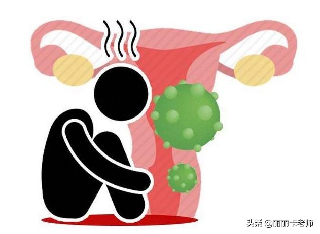 你真的了解宫颈癌术后冲洗的问题吗？