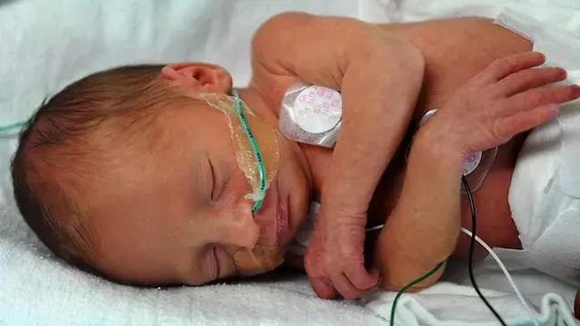 吸毒孕妇宝宝有可能是畸形吗,孕妇吸毒对孩子的危害