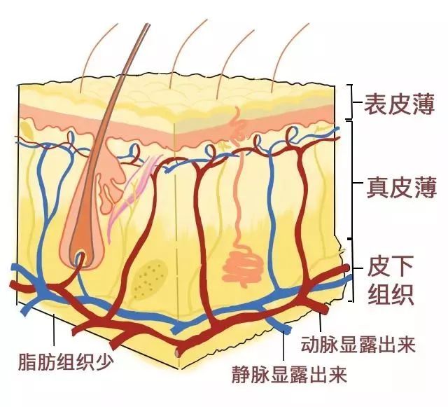 上眼皮黑眼圈是什么类型,黑眼圈的三种类型