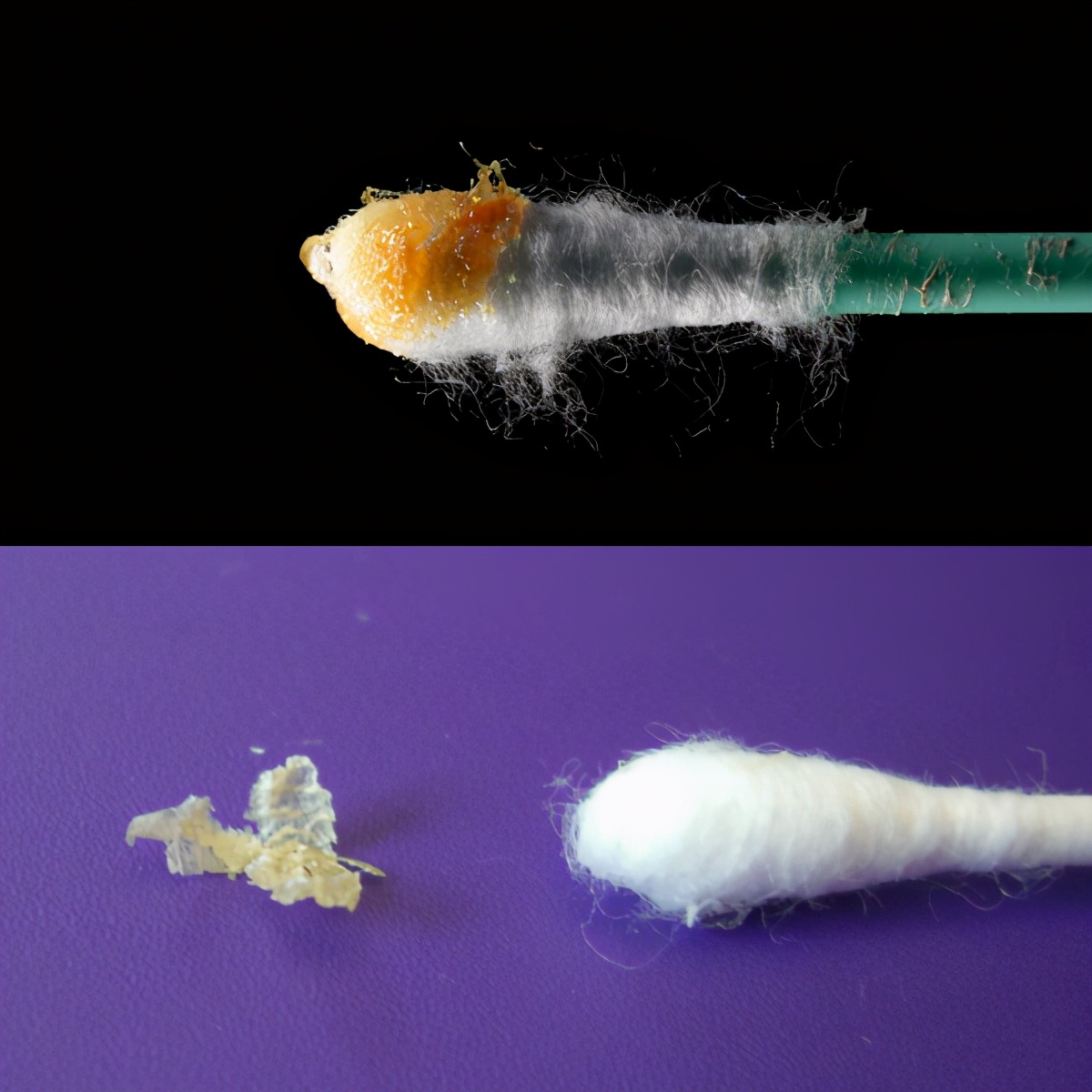 狐臭是怎么引起的,狐臭是怎么引起的啊