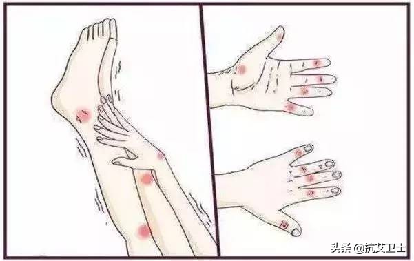 hiv合并梅毒可以痊愈吗,梅毒合并hiv感染的治疗方法