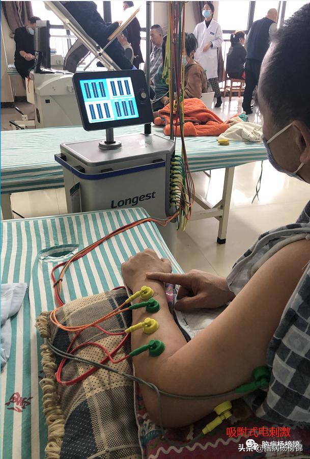 偏瘫三角肌疼痛的治疗,偏瘫患侧疼痛吃啥药