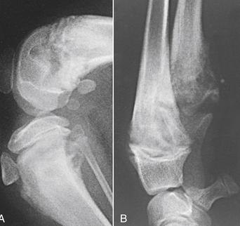 犬骨髓炎症状是什么,犬骨髓炎