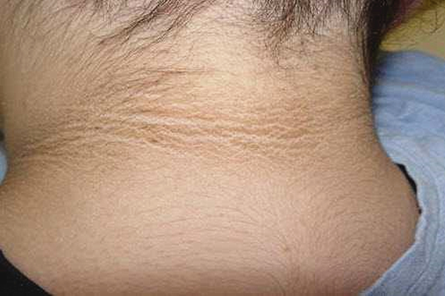 小孩子脖子黑像洗不干净用什么药,儿童脖子黑洗不掉用看医生吗