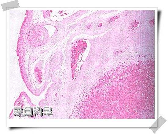 泌尿生殖科普知识,男性尿道科普