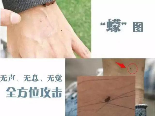 海南小黑虫咬人怎么防御,看到有小黑虫钻进伤口怎么办