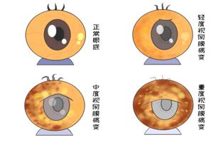 眼科免费义诊通知,眼科医院义诊