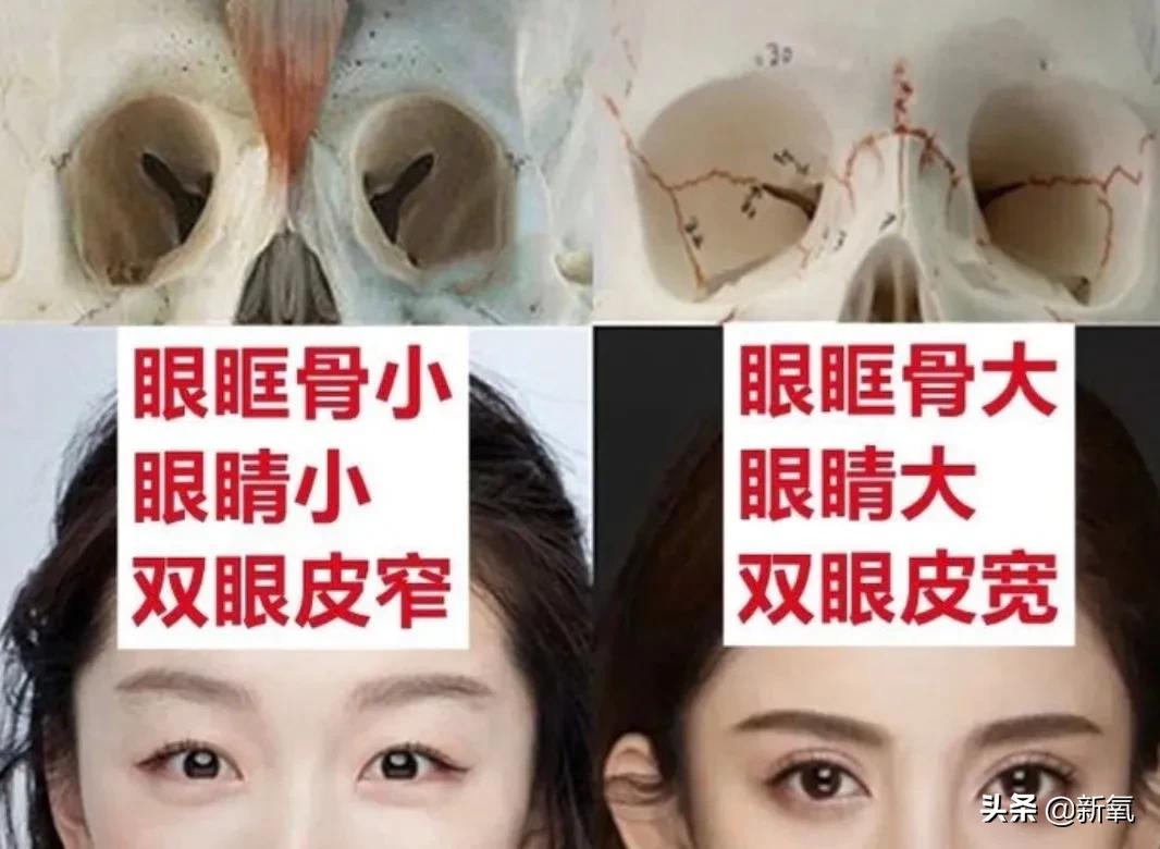 做双眼皮的姐妹还是要慎重,姐妹们你们割双眼皮多少钱