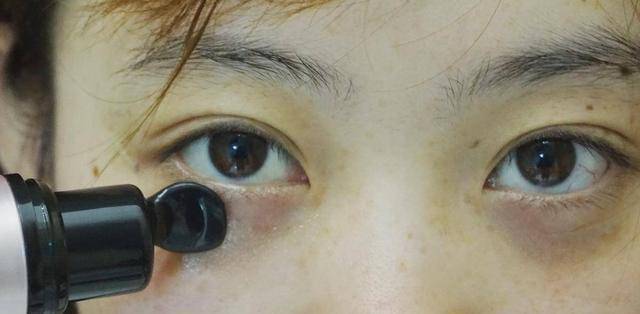 教你一个简单又长久的护眼方法,眼睛干涩的护眼方法