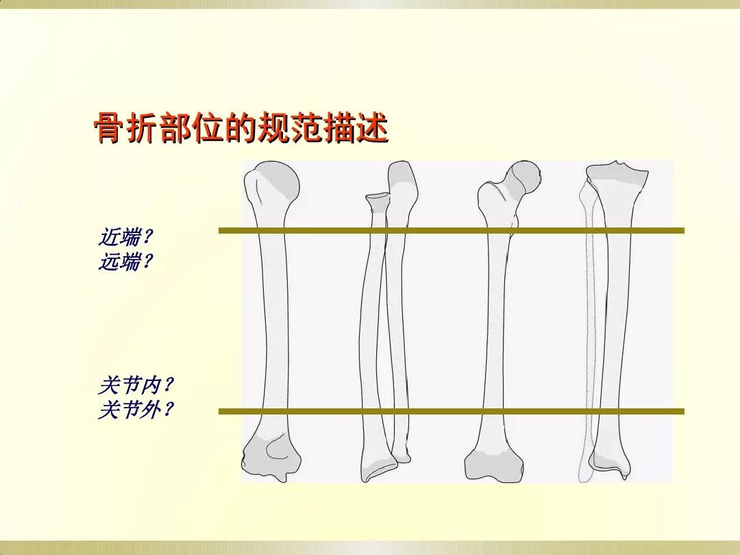 骨科x光片读片技巧,放射科骨科读片教程