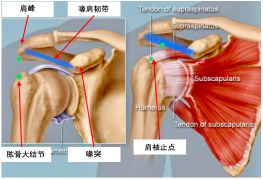 好多人以为是肩周炎其实是颈椎病,肩膀疼痛别总以为是肩周炎