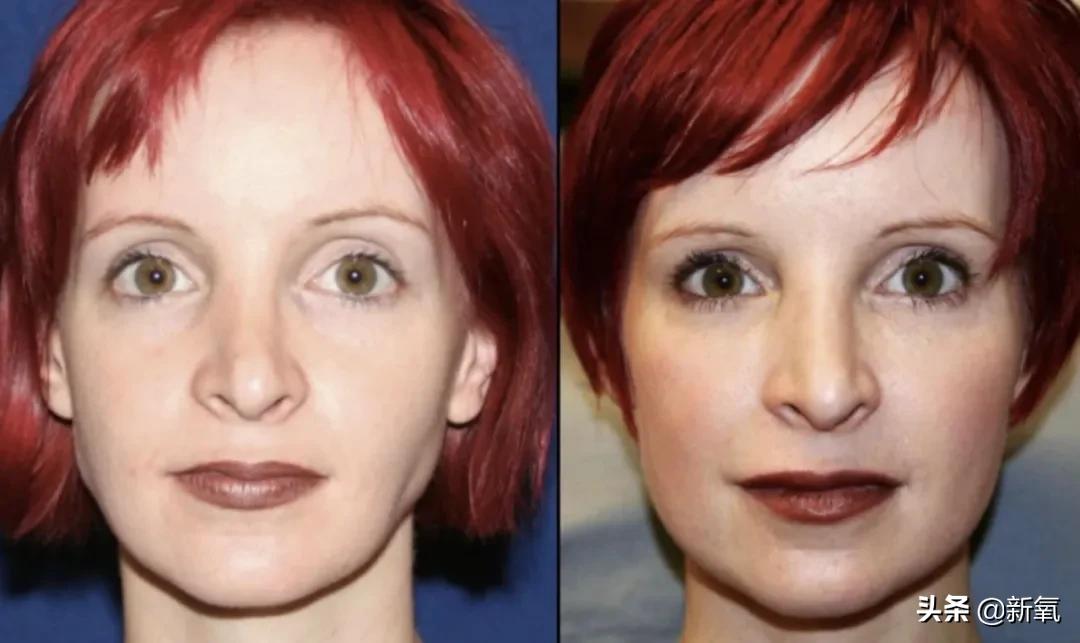 不老仙妻冻龄,不老仙妻40多岁看起来仅20岁