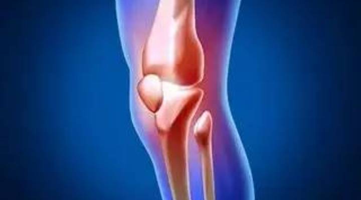 滑膜炎骨刺骨质增生怎么治,膝盖骨质增生长骨刺怎么治