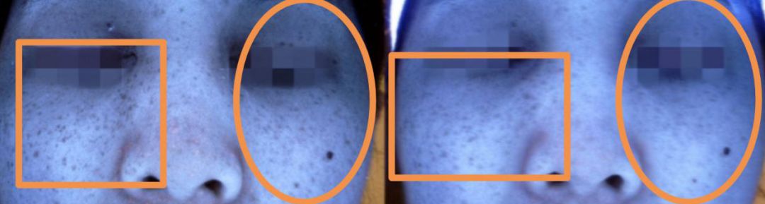 每周一次精准有效的皮肤管理,选对护肤方法让你做靓丽女神