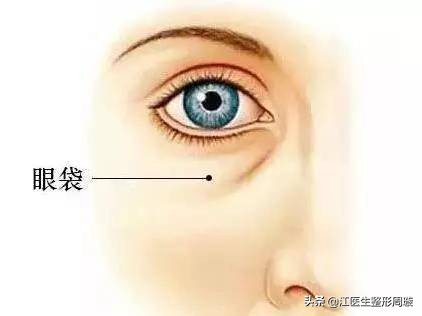 如何快速去除眼袋有效方法,如何快速去除眼袋和黑眼圈