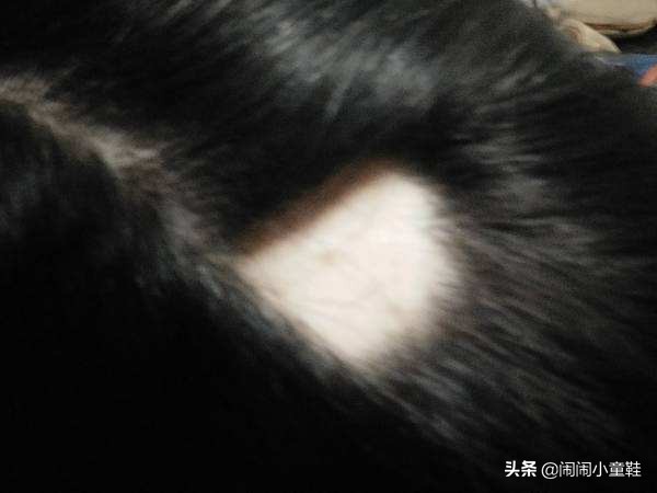 男士头发出油有头屑用什么洗发水,头发干枯毛躁痒有头屑掉发怎么办