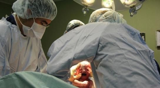 剖腹产宝宝自己从肚子里爬出来？分娩的时候宝宝和你一起在努力