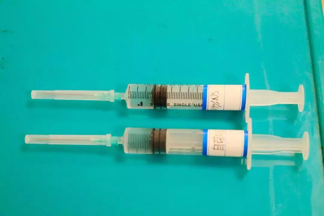 picc发生堵管时的处理方法,picc内置管堵了是什么原因