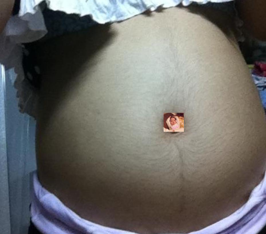 准妈妈怀孕肚皮上为啥会长毛？老人说是怀男宝的征兆，是真的吗？