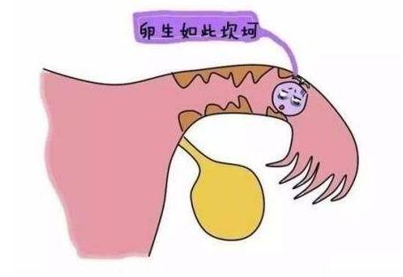 输卵管不孕指南,专治不孕不育输卵管疏通祖传秘方