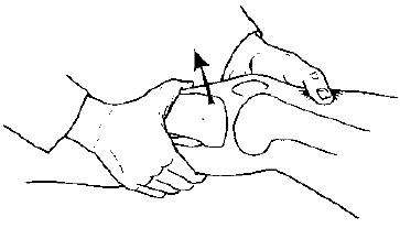 预防前叉松弛,前叉重建松弛能治愈吗