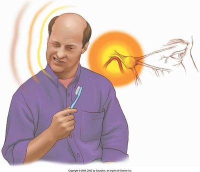 常见的头痛如何治疗好,各种原因引起的头痛怎么治疗