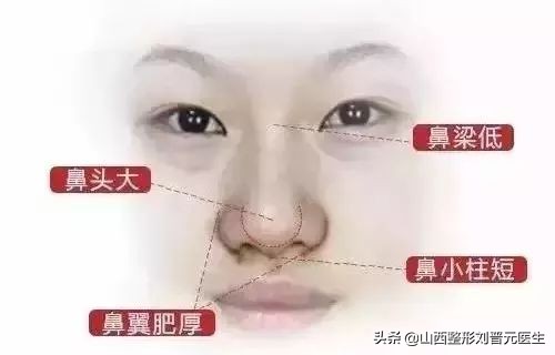 捏鼻子能让鼻梁变高,婴儿捏鼻梁变高真的吗