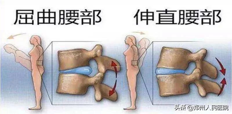 对骨科微创技术的认识,骨科手术与保守治疗对比