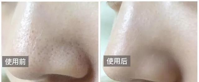 火山泥真是宝，油皮女孩的毛孔疏通剂，让贵妇霜3秒吃透锁水8倍