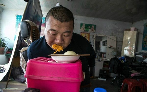 男子没有四肢,男子天生无四肢