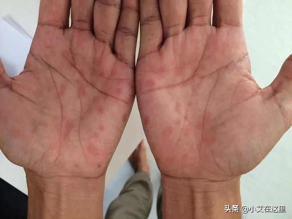 怕感染性病?这些知识,有无*生活性**都该知道