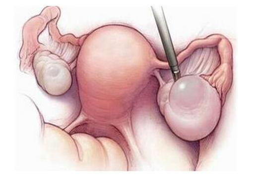 姑娘肚子疼咋办,女生肚子痛可以忍多久