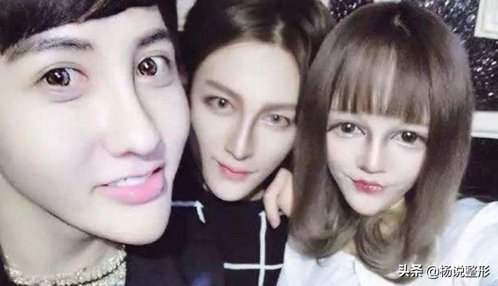 隆鼻整容老了会怎么样,隆鼻后老了