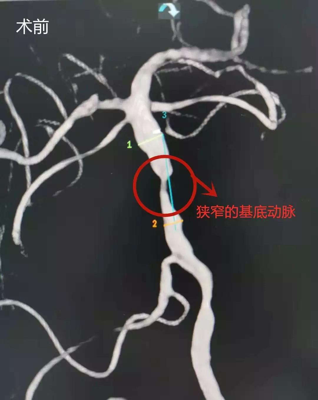 郑州中康医院新院区最新进展,郑州中康医院项目最新进展
