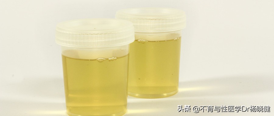 男人尿液浑浊有白色沉淀物严重吗,四十岁男人尿液浑浊深黄