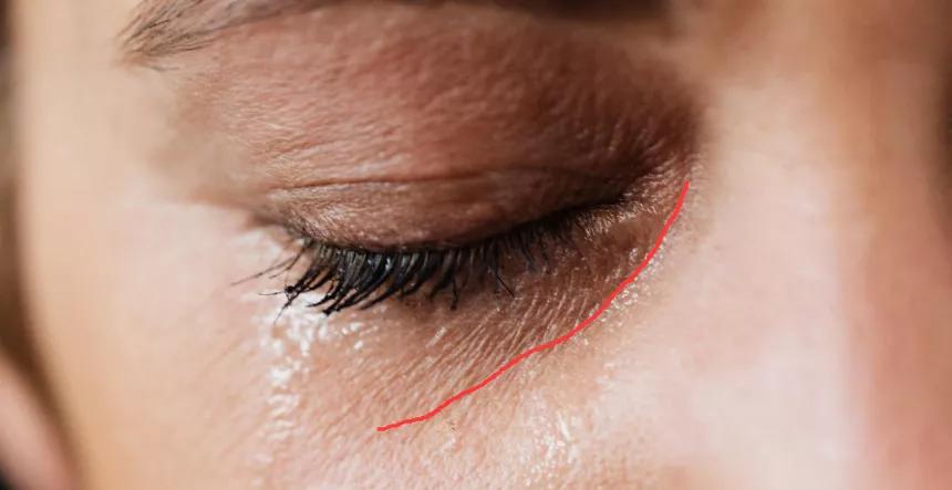 显老的八字纹,什么纹最显老又好看