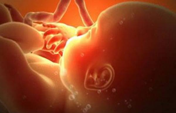 羊水少多喝水老上厕所有影响吗,孕期羊水少尿多