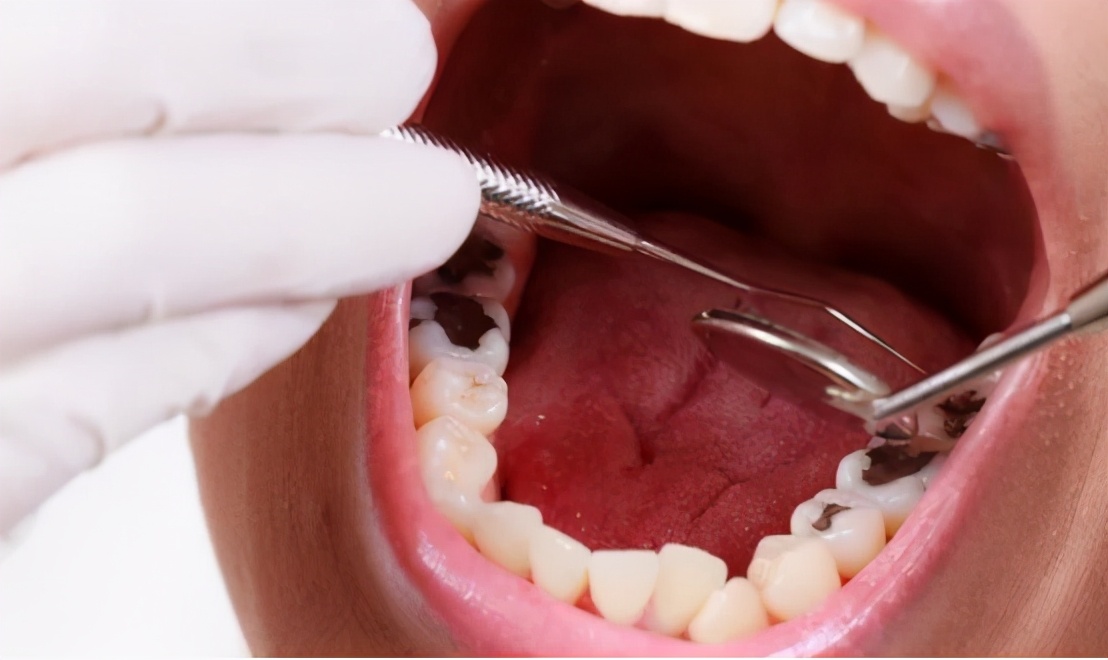 牙齿咬东西酸软无力用什么牙膏,牙齿酸软恢复小妙招真的有用吗