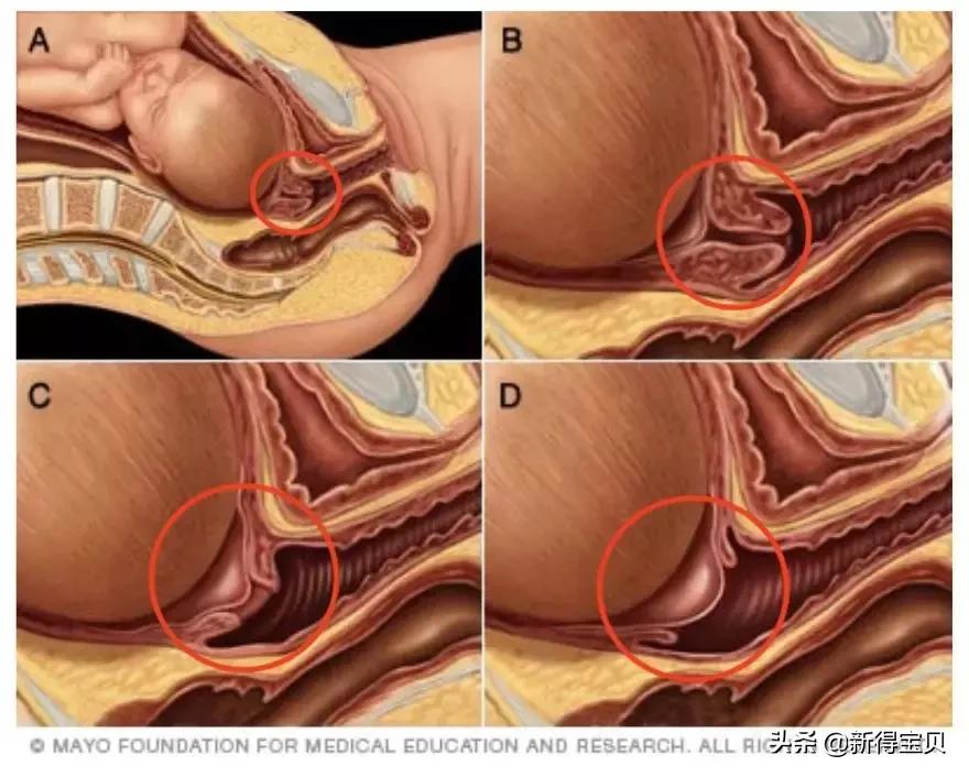 产房医护常用的四个暗语,产房暗语100个口诀