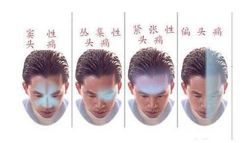 头痛的中西医鉴别诊断与治疗,头痛中医分型及方药