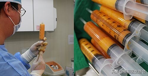 太阳穴凹陷颧骨高适合留中分吗,太阳穴凹颧骨高用什么哑光高光好