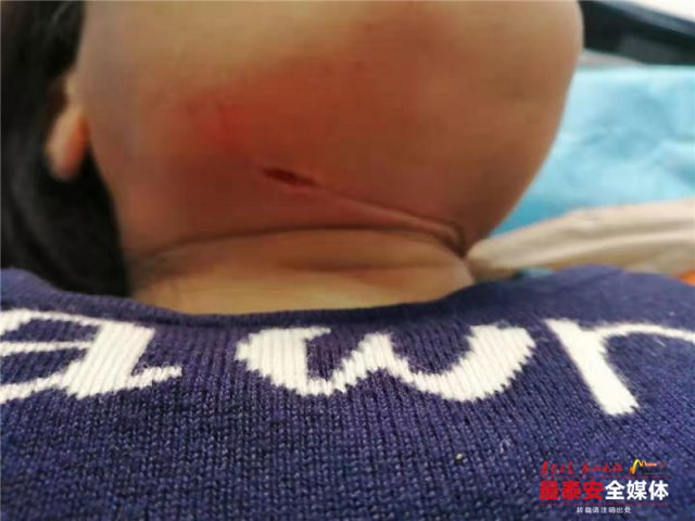 事发*安泰**!女子骑电动被风筝线割伤,割喉伤处缝补30多针