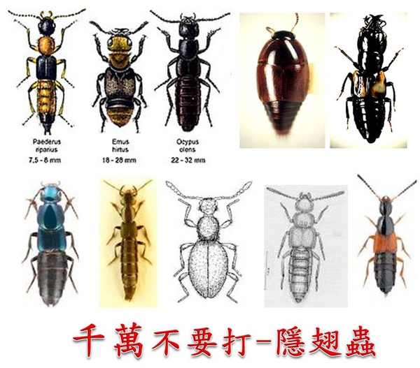 隐翅虫咬人后早期图片及症状,隐翅虫咬人后图片和症状